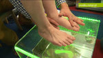 Zdrowe stopy , czyli jak rozpoznać i leczyć płaskostopie u dziecka